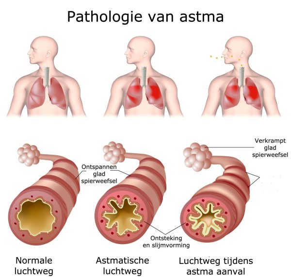 Astma vermoeidheid
