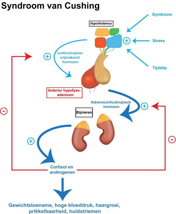 Syndroom van cushing