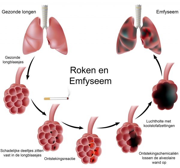 Longemfyseem