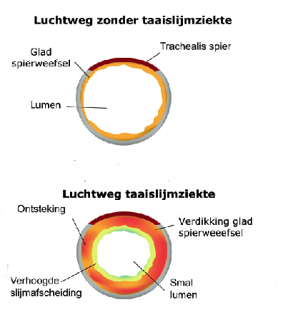 Taaislijmziekte