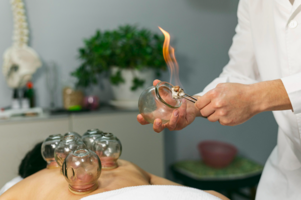 cupping massage met vlam
